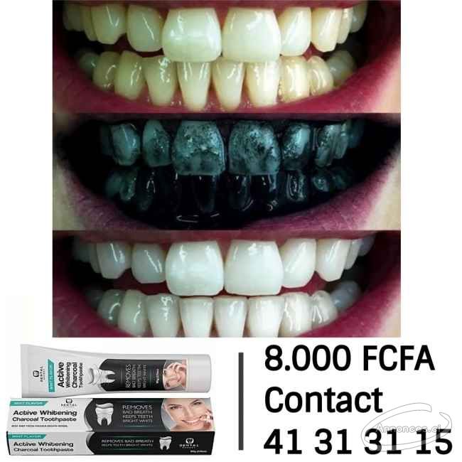 Blanchiment dentaire